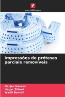 Impressões de próteses parciais removíveis (Portuguese Edition) 6208773016 Book Cover