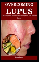 Overcoming Lupus: The Complete Guide To Permanently Cure And Reverse Lupus B09G9Q2XT6 Book Cover