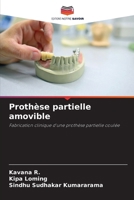 Prothèse partielle amovible (French Edition) 6630040503 Book Cover