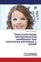 Transplantatsiya amnioticheskoy membrany pri patologii rogovitsy u detey 3659522554 Book Cover