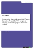 Indocyanine Green Injection (ICG). Tumor Detection Potential of ICG-navigated Imaging in Liver Surgery for Metastatic Lesions 3346768996 Book Cover