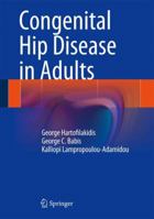 Congenital Hip Disease in Adults 8847054915 Book Cover