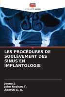 Les Procédures de Soulèvement Des Sinus En Implantologie (French Edition) 6208015499 Book Cover