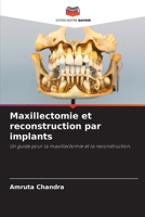 Maxillectomie et reconstruction par implants (French Edition) 6200083487 Book Cover