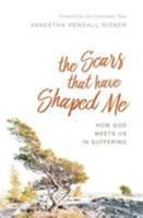 The Scars That Have Shaped Me: How God Meets Us in Suffering