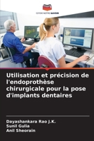 Utilisation et précision de l'endoprothèse chirurgicale pour la pose d'implants dentaires (French Edition) 6208687470 Book Cover