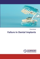 Failure in Dental Implants 6202526599 Book Cover