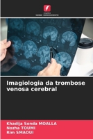 Imagiologia da trombose venosa cerebral (Portuguese Edition) 6208531616 Book Cover