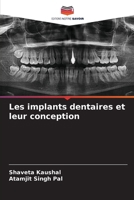 Les implants dentaires et leur conception (French Edition) 6630191005 Book Cover
