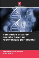 Perspetiva atual do enxerto ósseo na regeneração periodontal (Portuguese Edition) 6207698215 Book Cover