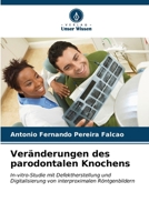 Veränderungen des parodontalen Knochens (German Edition) 620717805X Book Cover