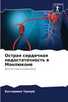 Острая сердечная недостаточность в Монлю 6204113372 Book Cover