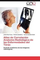 Atlas de Correlación Anatomo-Radiológica de las Enfermedades del Tórax 3847357190 Book Cover