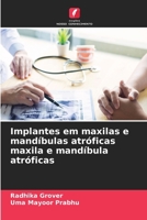 Implantes em maxilas e mandíbulas atróficas maxila e mandíbula atróficas (Portuguese Edition) 6208351332 Book Cover