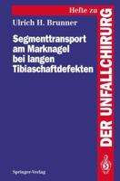 Segmenttransport Am Marknagel Bei Langen Tibiaschaftdefekten 3540581677 Book Cover