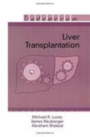 Liver Transplantation (Landes Bioscience Medical Handbook (Vademecum)) 1570596824 Book Cover