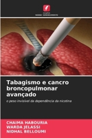 Tabagismo e cancro broncopulmonar avançado 6630189302 Book Cover