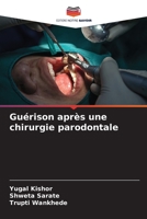 Guérison après une chirurgie parodontale (French Edition) 6206520188 Book Cover