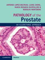 Pathology of the Prostate: An Algorithmic Approach 1108185657 Book Cover