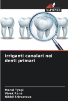 Irriganti canalari nei denti primari (Italian Edition) 6208036046 Book Cover