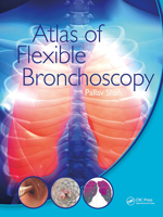 Atlas of Flexible Bronchoscopy 103247758X Book Cover