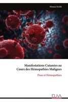 Manifestations Cutanées au Cours des Hémopathies Malignes: Peau et Hémopathies (French Edition) 9999331912 Book Cover