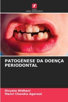 Patogénese Da Doença Periodontal 6205871424 Book Cover