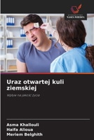 Uraz otwartej kuli ziemskiej 6209095119 Book Cover