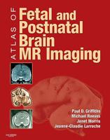 Atlas of Fetal and Postnatal Brain MR B01CMY8JX6 Book Cover