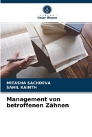 Management von betroffenen Zähnen 620360321X Book Cover