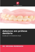 Adesivos em prótese dentária 6209631339 Book Cover