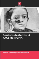 Sorrisos desfeitos: A FACE da NOMA 6206866769 Book Cover