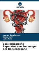 Coelioskopische Reparatur von Senkungen der Beckenorgane (German Edition) 6207711475 Book Cover