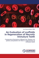 An Evaluation of scaffolds in Regeneration of Necrotic Immature Teeth: Comparative Evaluation of Blood Clot, Platelet rich plasma and platelet rich fibrin in regeneration of immature teeth 3659147869 Book Cover