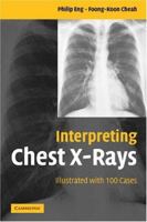 Interpreting Chest X-Rays: Illustrated with 100 Cases 0511545363 Book Cover