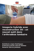 Imagerie hybride avec reconstruction 3D: un nouvel outil dans l'arthrodèse lombaire (French Edition) 6209676650 Book Cover