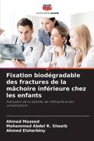 Fixation biodégradable des fractures de la mâchoire inférieure chez les enfants (French Edition) 6209630049 Book Cover