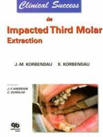 Clinical Success in Impacted Third Molar Extraction 2912550181 Book Cover