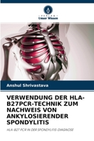 Verwendung Der Hla-B27pcr-Technik Zum Nachweis Von Ankylosierender Spondylitis 6203239496 Book Cover