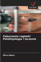 Zaburzenia rogówki Patofizjologia i leczenie (Polish Edition) 6208906156 Book Cover