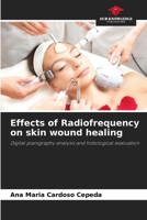 Effects of Radiofrequency on skin wound healing: Digital planigraphy analysis and histological evaluation 620766793X Book Cover