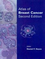 Atlas of Breast Cancer 1563750104 Book Cover
