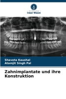 Zahnimplantate und ihre Konstruktion (German Edition) 6630180763 Book Cover