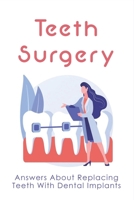 Teeth Surgery: Answers About Replacing Teeth With Dental Implants: Dental Implant Surgery B095GSMKZ2 Book Cover