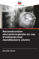 Reconstruction microchirurgicale en cas d'ostéonécrose mandibulaire sévère (French Edition) 6630098757 Book Cover
