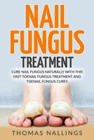 Nail Fungus Treatment: Cure Nail Fungus Naturally with This Fast Toenail Fungus Treatment and Toenail Fungus Cures 1539654192 Book Cover