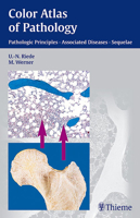 Color Atlas of Pathology: Pathologic Principles-Associated Diseases-Sequela 1588901173 Book Cover