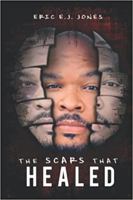 The Scars That Healed 1648101984 Book Cover