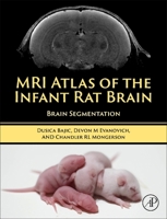 MRI Atlas of the Infant Rat Brain: Brain Segmentation 0323997678 Book Cover