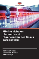 Fibrine riche en plaquettes et régénération des tissus parodontaux (French Edition) 6208065682 Book Cover